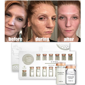 ZS coréen Anti-âge Enzyme masque <span class=keywords><strong>Miracle</strong></span> visage lifting blanchissant masque Facial ligne fine élimination des rides Peptides Essence ensemble - Product Image 2