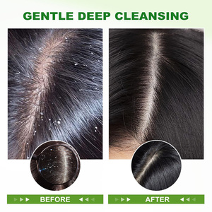 <span class=keywords><strong>Exfoliante</strong></span> Limpiador para Cuero Cabelludo y Champú Detox Puro de Romero para Control de Grasa y Cabello Sedoso, <span class=keywords><strong>Exfoliante</strong></span> de Romero y Menta para Cuero Cabelludo - Product Image 2