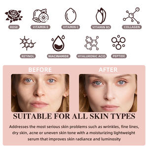 Private Label Niacinamide Verhelderende Anti Veroudering Rimpels Retinol Crème Serum <span class=keywords><strong>Rose</strong></span> Toner Gezichtsverzorging Set - Product Image 3