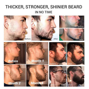 Olio per la Crescita della Barba 100% Vegano e Biologico per <span class=keywords><strong>Uomo</strong></span>, Etichetta Privata, Prodotto per la Cura Personale Maschile - Product Image 6