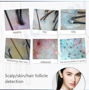 Análisis del cabello Productos para el cuidado del cabello Detector de folículos Máquina analizadora de cuero cabelludo inalámbrica WiFi - Product Image 6