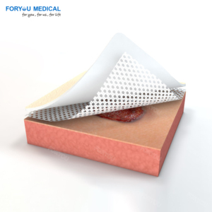 Capa de Gel de Silicona Porosa para Heridas - Previene la Maceración y Favorece la Curación Húmeda - Product Image 4