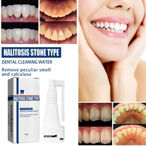 Spray buccal dissolvant le tartre dentaire Jayswing, parfum longue durée, dissout le tartre dentaire, la mauvaise haleine et le tartre. - Product Image 5