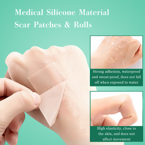 Parches Autoadhesivos Reutilizables para Cicatrices, Láminas de Gel de Silicona, Tiras Adhesivas para Estrías, Certificación CE Clase I - Product Image 6