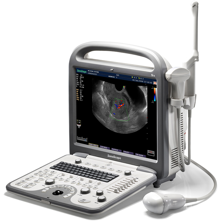 Ecografía ecógrafo 4D portátil Sonoscape S8 B/ 2B/ 4B/ M/CW Doppler Color