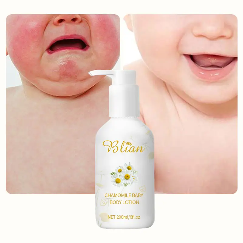 Oem Private Label Vegan Kamille Baby Kid Gezicht Lotion Kinderen Moisturizer Voorkomen Allergieën Eczeem Behandeling Gezichtscrème