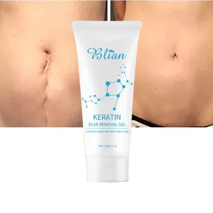 Krim Penghilang Bekas Luka Jerawat Yang Efektif, Krim Penghilang Bekas Jerawat, Krim Penghilang Stretch Mark Pengencang Peregang Perata Perut Gel Wajah