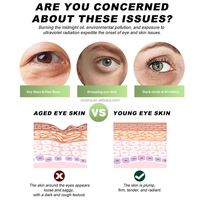 OTVENA 100% Réduit les poches sous les yeux Effet instantané Raffermissement rapide Raffermissement Cernes Tous types de peau 12ml
