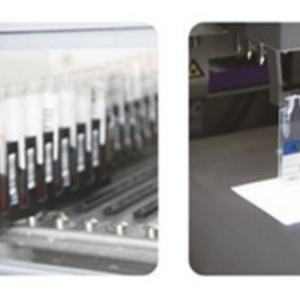 Guaranteed Quality Blood Group Machine Unique Blood <strong>Chemistry</strong> Analyzer Instrument Machine BGA-16 - Product Image 6