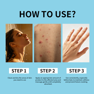 Crema Hidratante Nutritiva de 24 Horas para el Cuidado de la Piel, Calmante para Piel Sensible con Problemas de Psoriasis, Venta al Por Mayor - Product Image 5