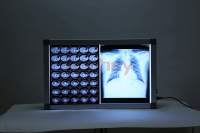 GINEE MEDICAL visionneuse de film à rayons X pour hôpital visionneuse de film à rayons X à LED pour hôpital machine à scanner à panneau unique