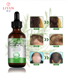 Huile de Batana Bio Naturelle Personnalisée OEM 118ml/flacon pour la Croissance Capillaire, Réparation, Nutrition et Épaississement des Cheveux pour Hommes et Femmes - Product Image 1