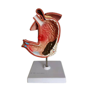 Modèle anatomique d'estomac malade pour l'enseignement médical, modèle de muqueuse gastrique, modèle de gastrite et d'ulcère - Product Image 4