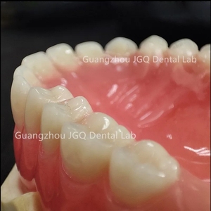 Las dentaduras postizas de boca completa personalizadas, los dientes acrílicos ofrecen una estabilidad mejorada para masticar, comer y hablar con un precio asequible - Product Image 1