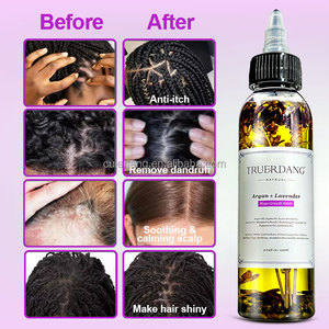 Private Label <strong>Hair</strong> Loss Regrowth Growing <strong>Oils</strong> Treatments <strong>Biotin</strong> Herbal Nattural Nourishing <strong>for</strong> Rapid <strong>Hair</strong> Growth <strong>Oil</strong> Wholesale - Product Image 5