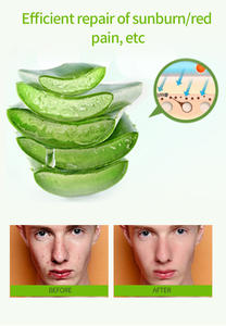 Usine En Gros Naturel Aloe Vera Crème Antibactérienne Effacer <span class=keywords><strong>Les</strong></span> <span class=keywords><strong>Boutons</strong></span> Du Visage <span class=keywords><strong>Pommade</strong></span> Antibactérienne - Product Image 5