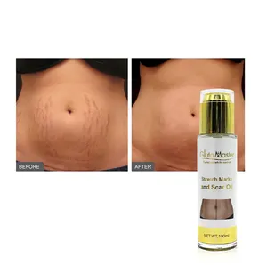 Private Label Melhor Anti Stretch Mark Creme Remoção Gravidez Cicatriz Stretch Mark Creme Oil