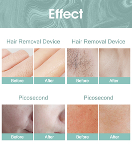 2026 Permanent Hair Removal <b>Machine</b> 3 Wavelength 790nm 808nm 1060nm Hair Removal Remover Home Use Device - Product Image 5