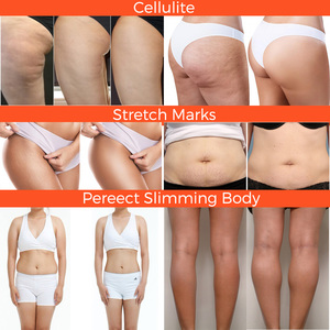 Offre Spéciale Bio Corps Slim Anti <span class=keywords><strong>Cellulite</strong></span> <span class=keywords><strong>et</strong></span> Vergetures Crème Vergetures Raffermissante Vergetures Crème <span class=keywords><strong>Cellulite</strong></span> - Product Image 2