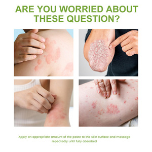 Pommade pour la peau à l'aloe vera spécialement conçue pour traiter la teigne cruris, l'eczéma, les démangeaisons et les infections fongiques - Product Image 4