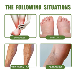 South Moon <strong>Best</strong> Instant Relief <strong>Varicose</strong> <strong>Vein</strong> <strong>Cream</strong> Soreness Swelling Earthworm Leg Relieving Spider <strong>Vein</strong> Removal <strong>Cream</strong> - Product Image 3