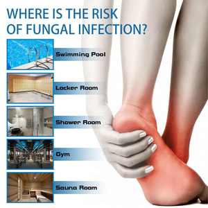 Spray <span class=keywords><strong>para</strong></span> Pies Ximonth al por Mayor, Marca Privada, 50 ml, Alivio del Dolor, Antifúngico, Fórmula Natural, Antipicazón, Cuidado <span class=keywords><strong>para</strong></span> el <span class=keywords><strong>Pie</strong></span> <span class=keywords><strong>de</strong></span> <span class=keywords><strong>Atleta</strong></span> - Product Image 3