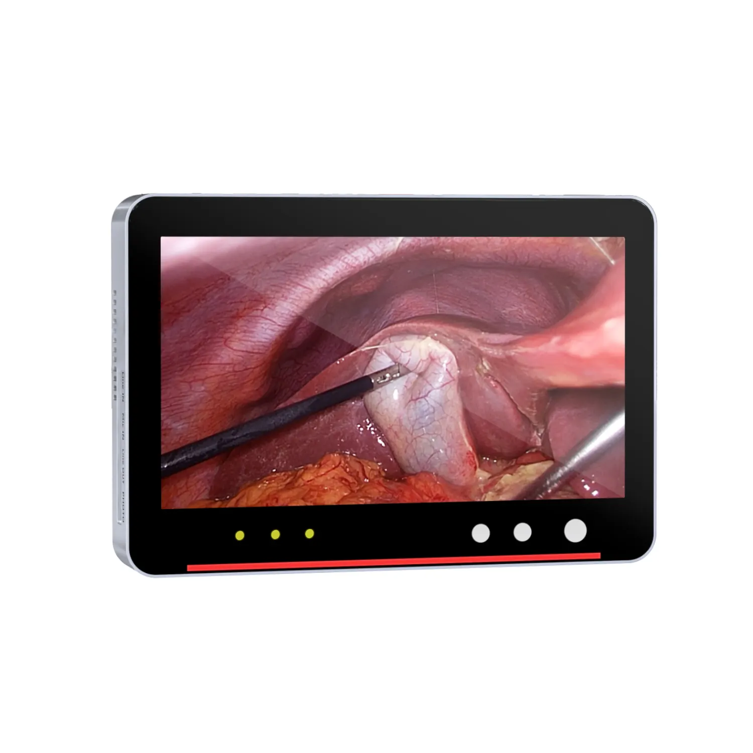 Unisheen Full HD Medical Endoscope Camera System With 80W LED Light Source And USB Video Recorder with battery holder