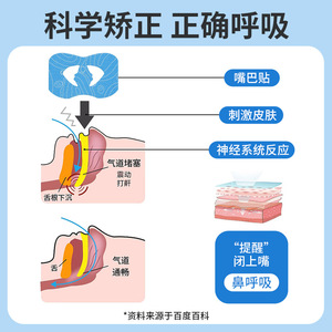 Anti Snoring Patch Adult Breathing Mouth Shaping Non Woven Fabric Cartoon Design One Size - Product Image 4
