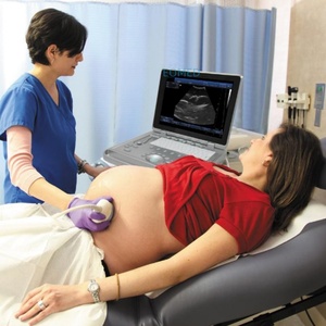 Escáner de Ultrasonido Multipropósito para Uso Humano y Veterinario con Modo Doppler PW, Máquina de Ultrasonido Obstétrico Portátil BW09 - Product Image 6