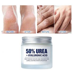 Crema de Urea con Ácido Hialurónico Personalizada de Marca Privada, Crema de Urea para Pies, Crema de Urea con Ácido Salicílico, Cuidado de la Piel, Hidratante - Product Image 4
