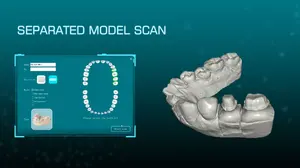 מעבדה Intraoral Extraoral Aoralscan 3D שיניים 3D סורק