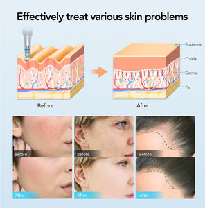 Nuevo <span class=keywords><strong>Dr</strong></span>. <span class=keywords><strong>Pen</strong></span> M7S Profesional Inalámbrico con Cartucho de 16 Pines para Uso Doméstico, Cuidado de la Piel MTS - Product Image 3