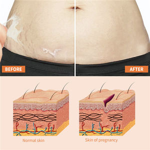 OEM Doğal Bitki Özlü Çatlak İzi Onarıcı Yağ, Hamilelik Cilt Bakımı, Yara İzi Yatıştırıcı ve Nemlendirici Destek 100ml - Product Image 6