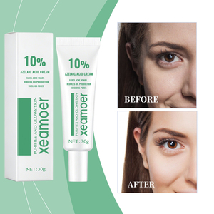 <span class=keywords><strong>Crema</strong></span> Hidratante Orgánica Personalizada <span class=keywords><strong>para</strong></span> Enrojecimiento y Hinchazón, Elimina Puntos Negros, Retiene la Humedad, Suave y Antiacné - Product Image 3