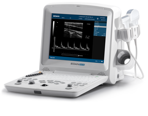 Échographe vétérinaire numérique Edan DUS 60 de haute qualité avec écran TFT-LCD 12,1 pouces pour hôpital - Product Image 1