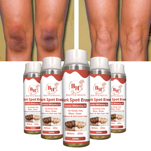 Aceite Blanqueador de Semillas de Vitamina E Frescas de Marca Privada, Reducción Efectiva de Manchas Oscuras, Reducción de Melanina, Blanqueamiento de Piernas y Codos, Esencial Puro - Product Image 1