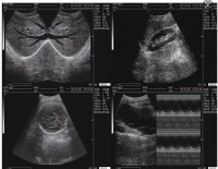 Sistema de diagnóstico por ultrassom digital completo portátil para uso em animais de estimação, instrumento veterinário portátil de baixo preço - Product Image 3