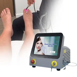 Диодный лазер класса IV 980 нм для лечения грибка ногтей/подибарии/подошвенного фасцита/бородавок ног и онихомикоза