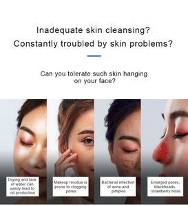 Removedor de Puntos Negros al por Mayor, Limpiador Facial con Succión de Poros, 6 Cabezales de Succión, 3 Niveles Ajustables para Mujeres y Hombres - Product Image 2