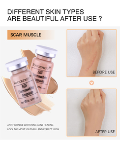 Kit de démarrage <span class=keywords><strong>BB</strong></span> Cream Glow Serum, essence faciale, fond de teint liquide avec niacinamide/peptide <span class=keywords><strong>pour</strong></span> éclaircir la <span class=keywords><strong>peau</strong></span> et lutter contre les rides - Product Image 6