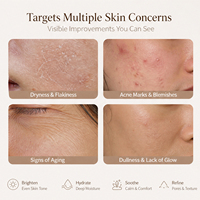 Özel Marka %2 Alfa Arbutin Aydınlatıcı Serum Koyu Lekeleri Giderici Niacinamide Ginseng Pirinç Beyazlatıcı Yüz Serumu OEM