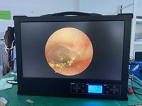 Sistema de endoscopia de pantalla de luz de cámara todo en uno para cirugía mínimamente invasiva Imágenes en tiempo real con diseño portátil ergonómico
