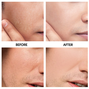 <span class=keywords><strong>Crema</strong></span> blanqueadora orgánica diaria para rostro y cuerpo de alta calidad, Bálsamo hidratante Facial con infusión de glicerina para hombres, mujeres y adultos - Product Image 6