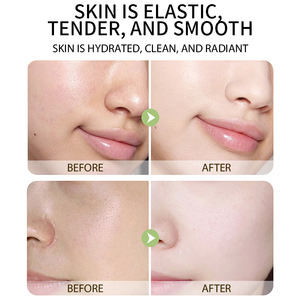 Nemlendirici bakım gençleştirici parlaklık pürüzsüz hassas <span class=keywords><strong>toner</strong></span> oem gliserin cilt toneri centella kar çim ance tonlama <span class=keywords><strong>toner</strong></span> kaldırma - Product Image 5