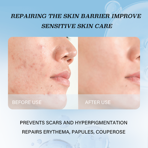 Cicatriz superficial <span class=keywords><strong>y</strong></span> reparación de pigmentación después de la cirugía estética de trauma Mascarillas faciales antienvejecimiento colágeno tipo III - Product Image 6