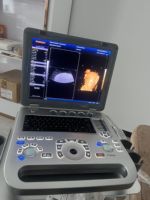 128 elemen resolusi tinggi warna Doppler mesin Ultrasound cerdas 3D/4D Notebook Ultrasound USG