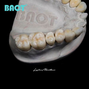 Kit Professionale PFZ per Riempimento Dentale, Set di Materiali in Porcellana, Polvere Ceramica Dentale, Kit Master per Odontoiatri - Product Image 5