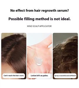 Aplicador de aceite para el cabello, peine para masaje del cuero cabelludo, herramienta portátil para el cuidado del cabello para uso diario - Product Image 5