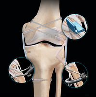 Kit d'instruments de reconstruction articulaire en acier inoxydable pour dislocation de l'épaule, guide de perçage orthopédique et kit de visée pour arthroscopie
