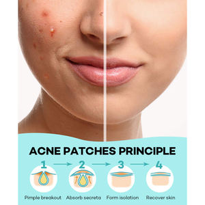 20 Patch 8 + 12mm perhatian untuk bentuk bulat jerawat Patch penutup noda stiker grosir hidrokoloid jerawat Patch - Product Image 6